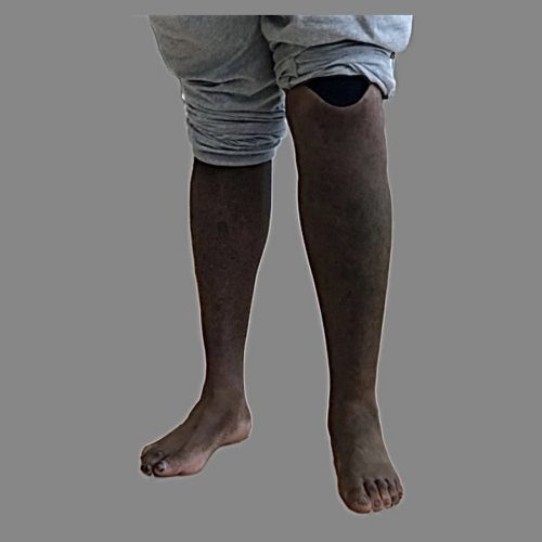 Cosmetic Silicone Skin